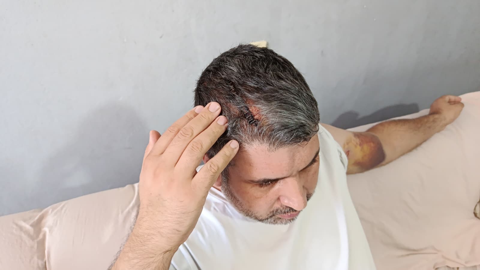Adana'da Miras Kavgasında Yeğenini Sopayla Yaralayan Dayı Tutuklandı (2)