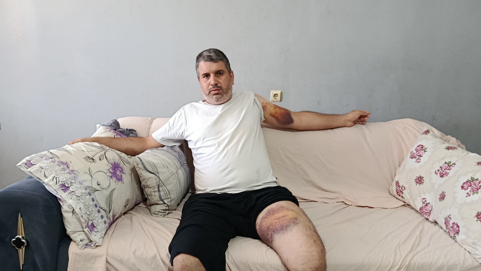 Adana'da Miras Kavgasında Yeğenini Sopayla Yaralayan Dayı Tutuklandı (3)