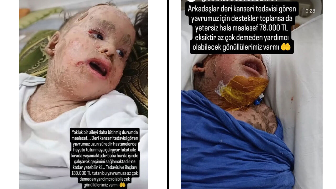 2 Yaşındaki Yusuf’un Umudu Çalındı Yardım Paraları Dolandırıcılara Gitti3