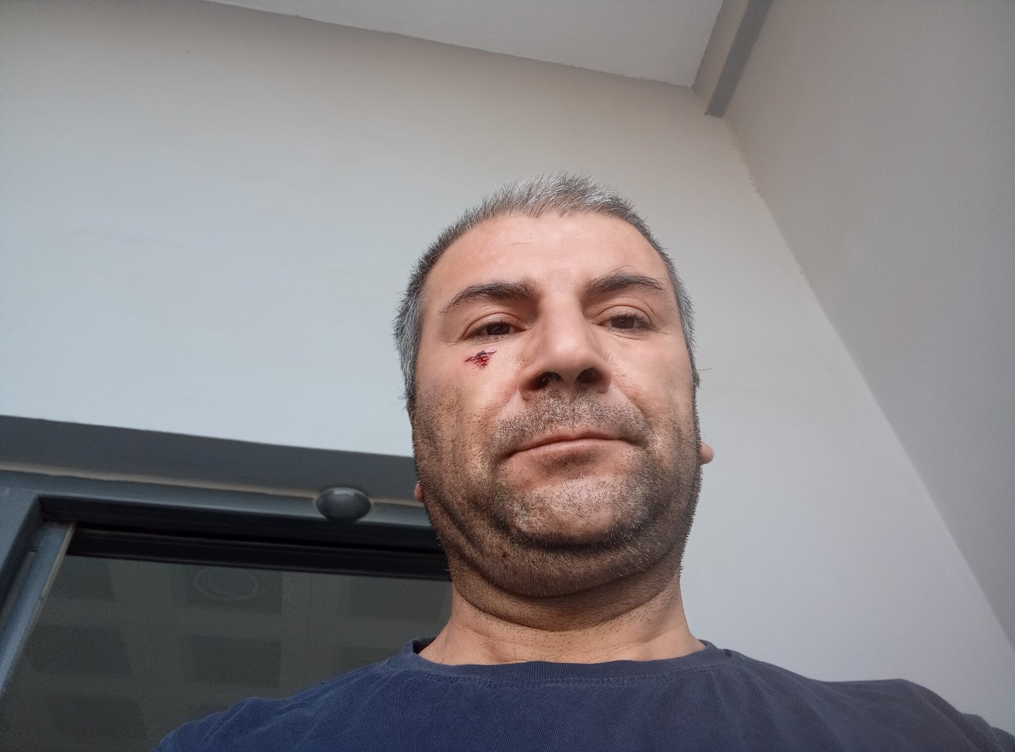 Adana'da “Kenara Çekilir Misiniz” Uyarısı Kanlı Bitti (1)