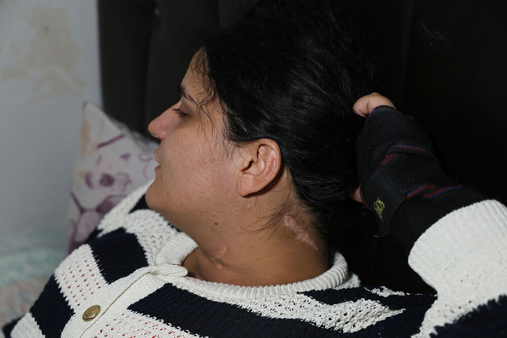 Adana’da Eş Dehşeti! Boğazını Kesti, Engelli Bıraktı (2)