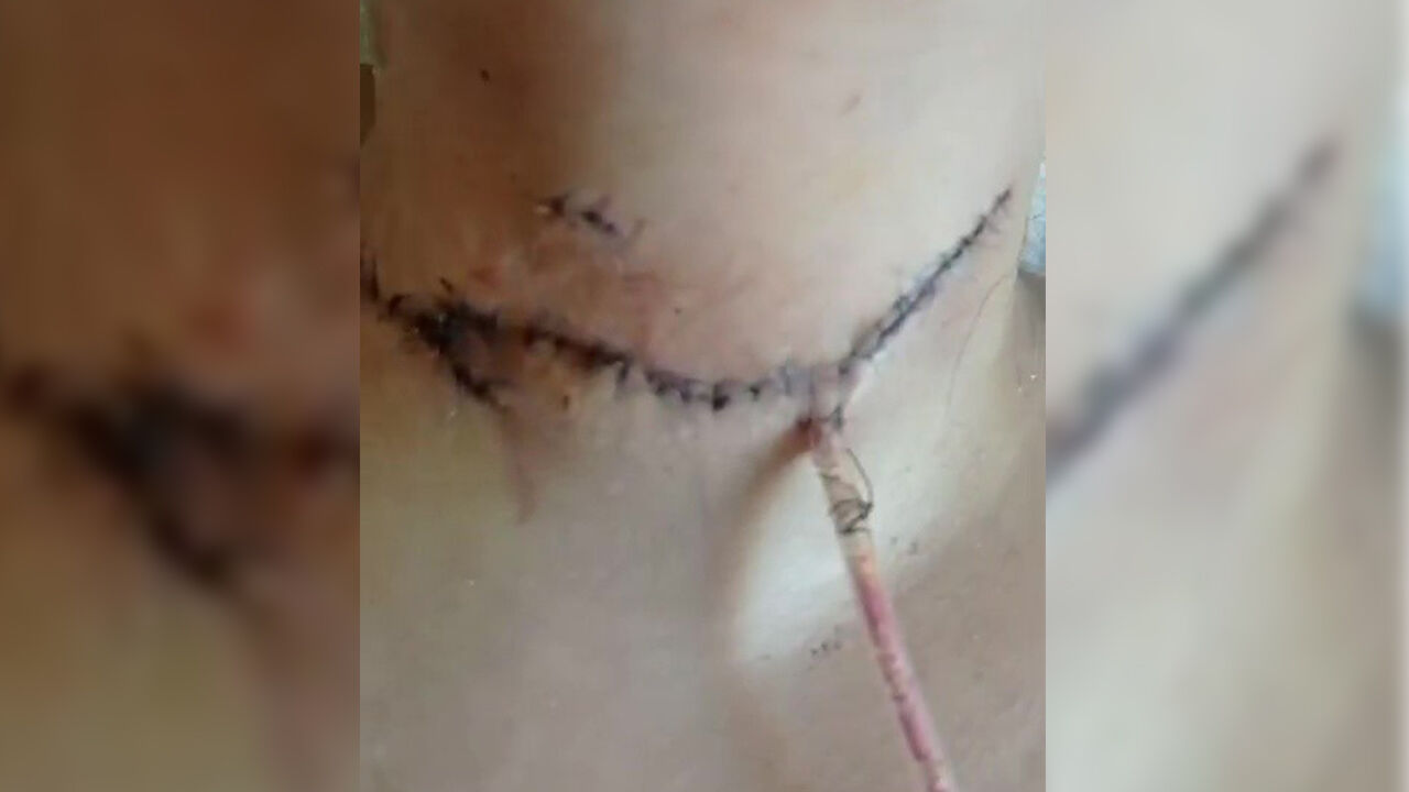 Adana’da Eş Dehşeti! Boğazını Kesti, Engelli Bıraktı44