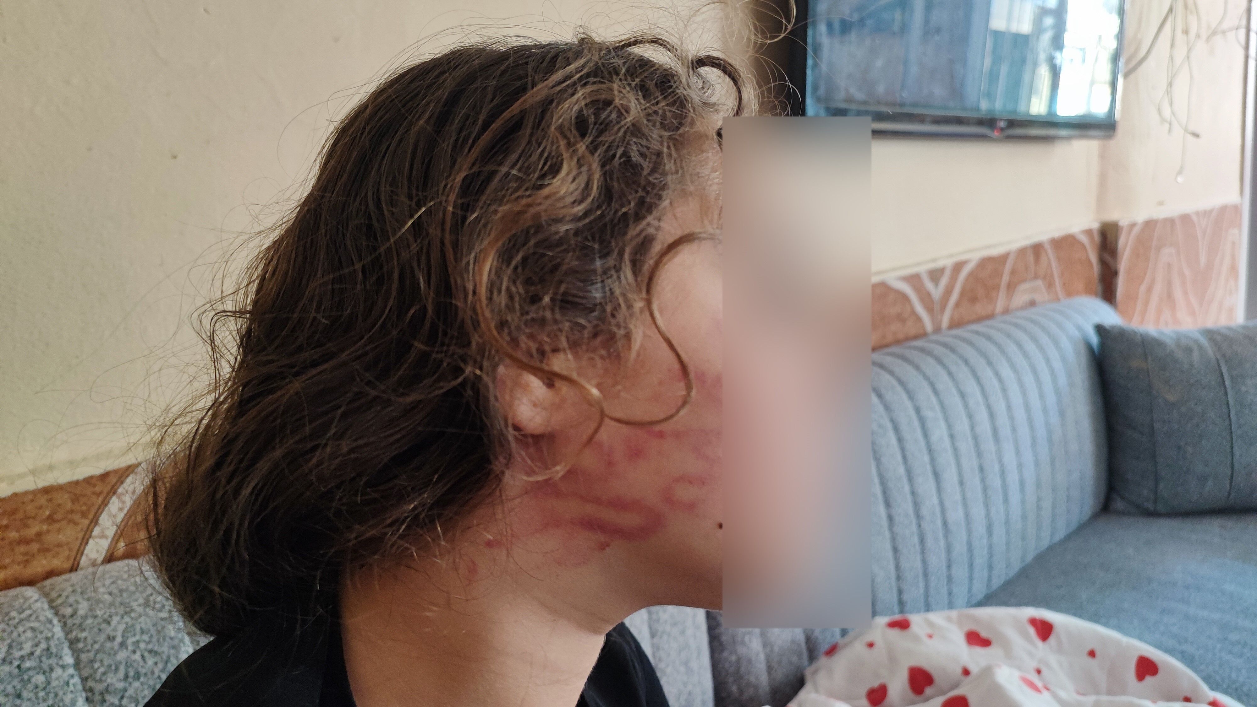 Adana’da Çocuk Kavgası Sonrası Ortalık Karıştı Küçük Kızın Dişleri Kırıldı (1)