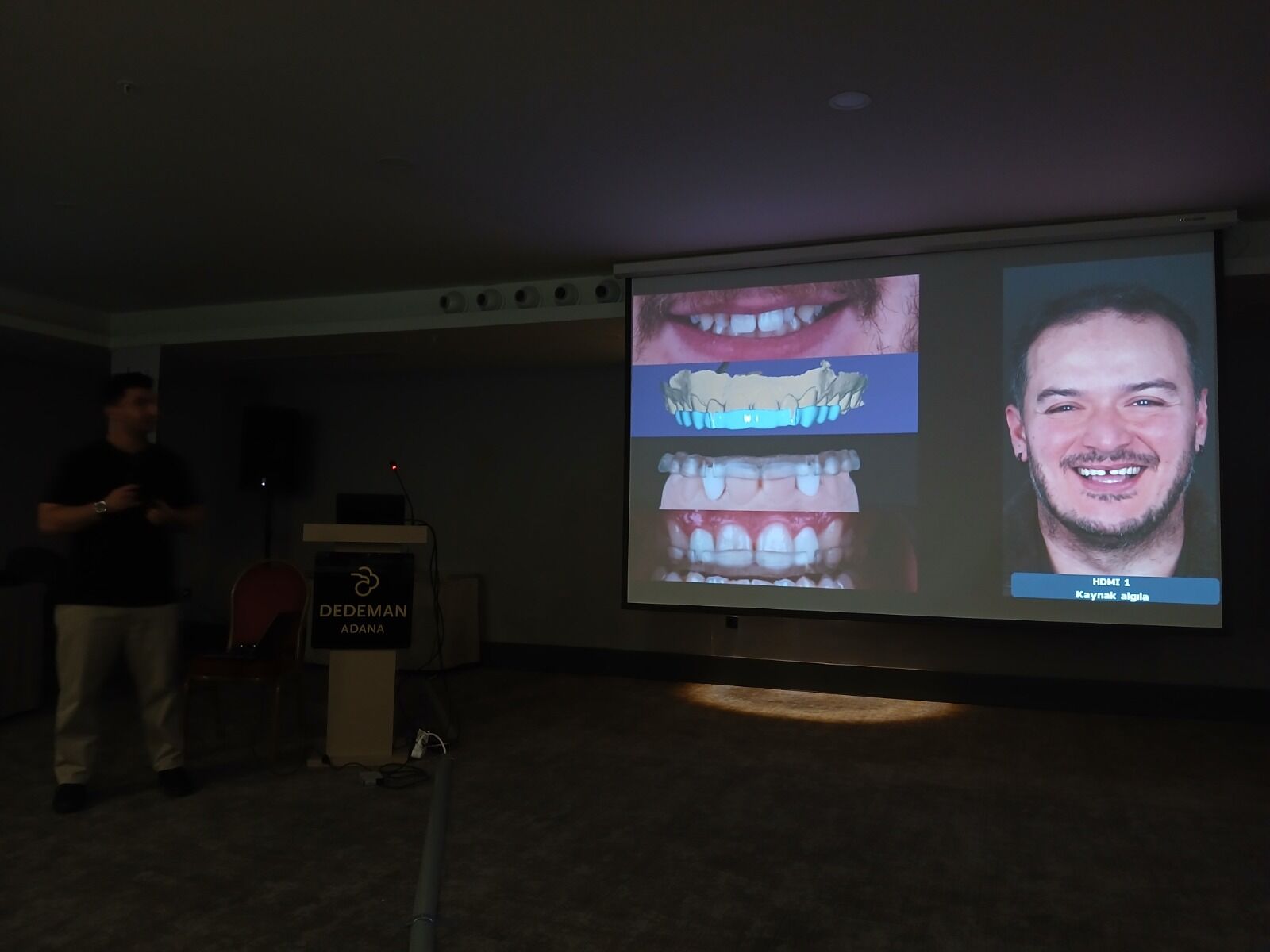 Adana’da Implant Teknolojileri Masaya Yatırıldı4