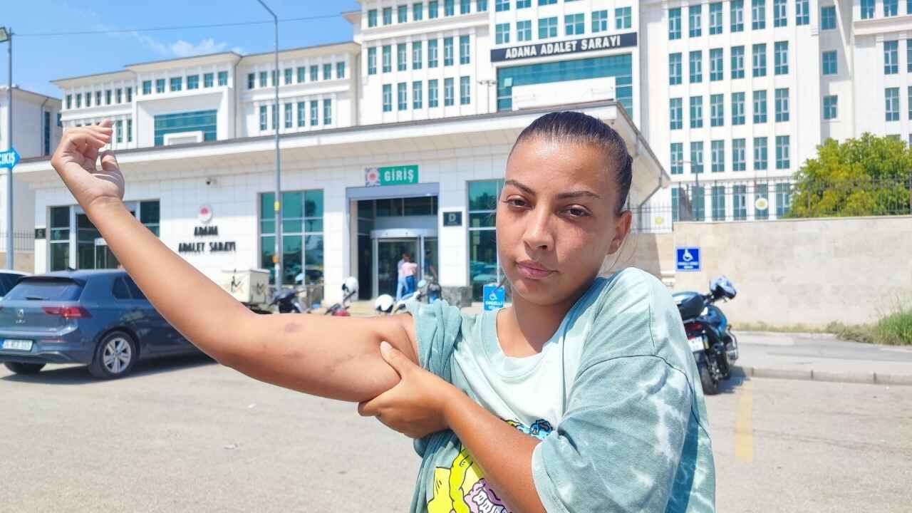 Adana’da Aile Içi Arazi Kavgası Amcasının Yeğenini Darbettiği Anlar Kamerada