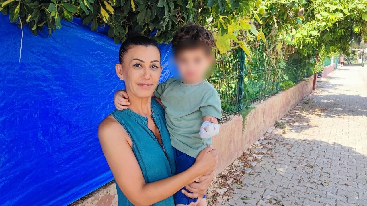 Adana'da Eli Parke Taşlarına Sıkışan 3 Yaşındaki Mustafa Kemal'e Polis Eskortu