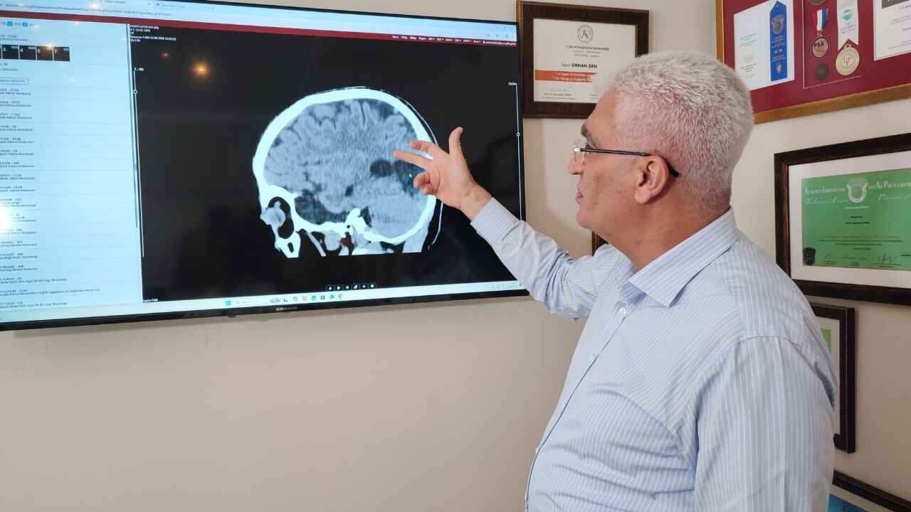 Pandemi sonrası inme vakalarına dikkat: Prof. Dr. Orhan Şen uyardı