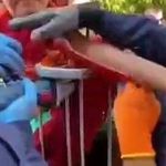 Bahçe oyununda korkunç kaza: Çocuğun koluna demir saplandı