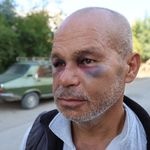 Kozan'da engelli vatandaşı darp ettiler