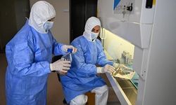 Türkiye’nin İlk Deri Bankası Adana’da Hizmete Girdi