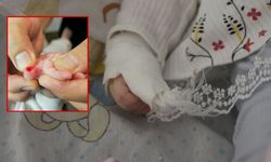 Hastanede akılalmaz iddia! 5 Aylık bebeğin parmağı kesildi