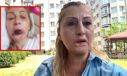 Estetik işlem sonrası dudağı çürüdü, 7 yıldır adalet arıyor