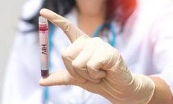 Seyhan Belediyesi'nden Ücretsiz ve Anonim HIV testi hizmeti