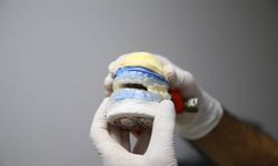 Adana'da tıp dünyasını gururlandıran gelişme!