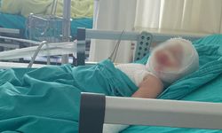 Patlayan domates konservesi 9 aylık bebeği yaktı! Aylarca tedavi gördü