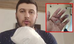 Sipariş beklerken kabusu yaşadı! Döner bıçağıyla saldırıya uğradı