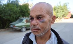 Kozan'da engelli vatandaşı darp ettiler