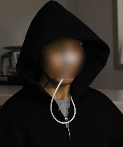 Antalya’da botoks kabusu: 20 kişi hastanelik oldu