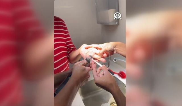 Adana'da yüzük çıkarılamayınca itfaiye devreye girdi
