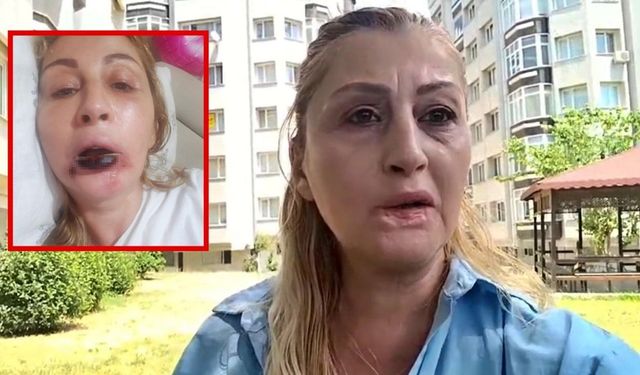 Estetik işlem sonrası dudağı çürüdü, 7 yıldır adalet arıyor