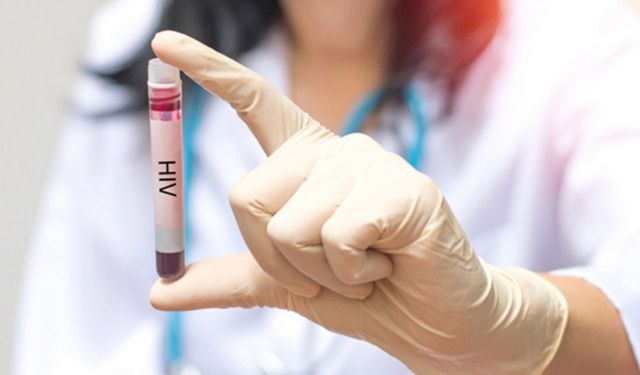 Seyhan Belediyesi'nden Ücretsiz ve Anonim HIV testi hizmeti