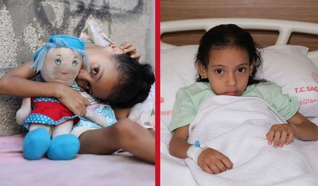 Filistinli Sıla’nın tedavisi Adana Şehir Hastanesi’nde sürüyor