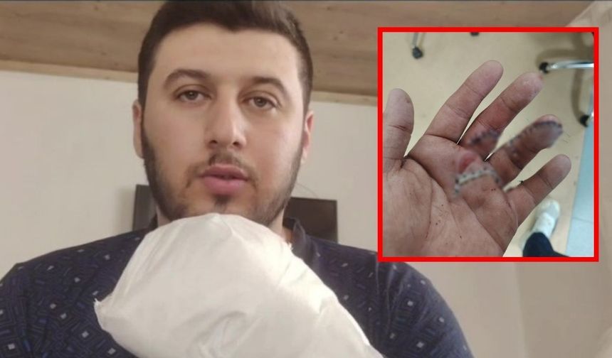 Sipariş beklerken kabusu yaşadı! Döner bıçağıyla saldırıya uğradı